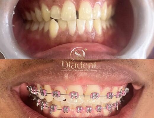 Consultorio Dental Diadent