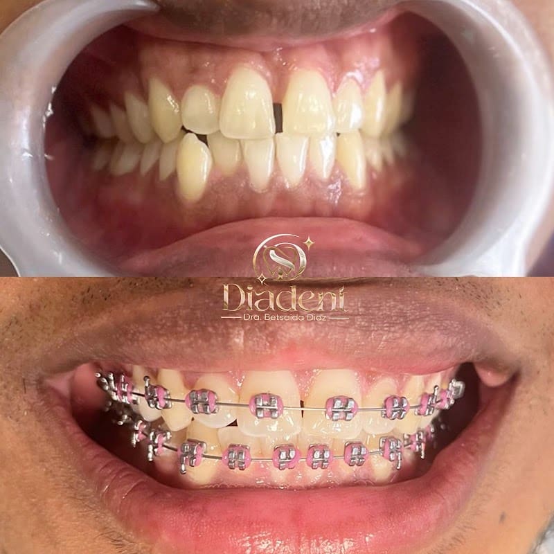 Consultorio Dental Diadent