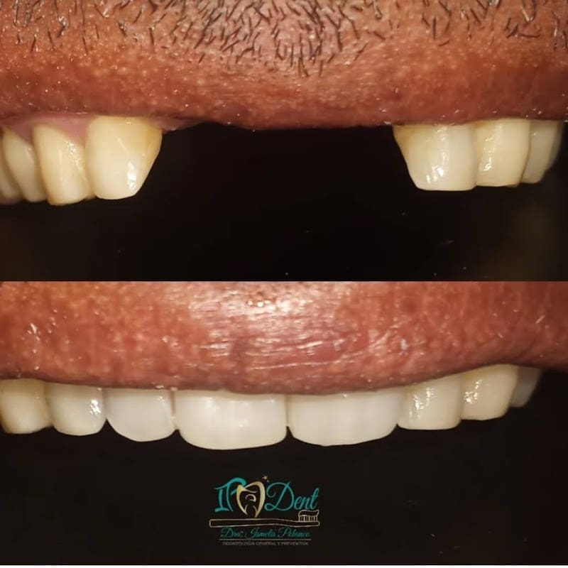 Consultorio Dental Dra. Ismelis Polanco IPA