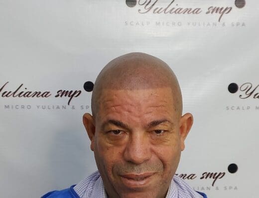 Yuliana Spa | Micropigmentación Capilar