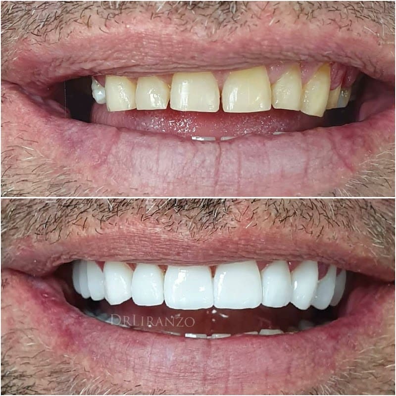 Centro Dental Doctor Liranzo