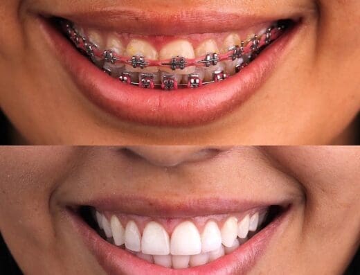 Estética Dental Dr. Jonathan Rodríguez