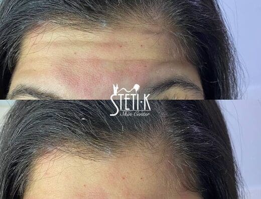 Steti K Skin Center